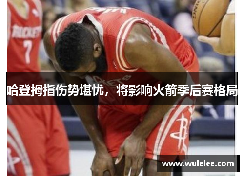 哈登拇指伤势堪忧，将影响火箭季后赛格局